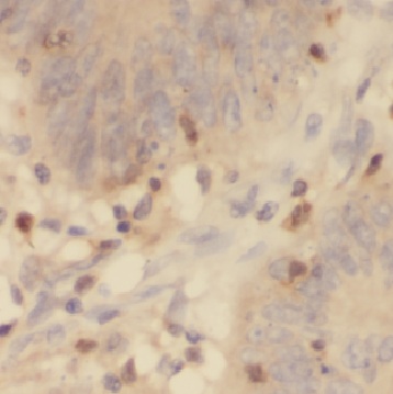CYP4F12 antibody|CYP4F12抗体