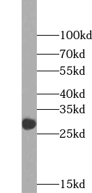 WFDC1 antibody|WFDC1抗体