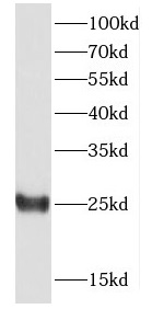 DTD1 antibody|DTD1抗体