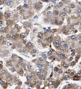 PSAP antibody|PSAP抗体 FNab06844