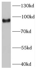 SV2C antibody|SV2C抗体