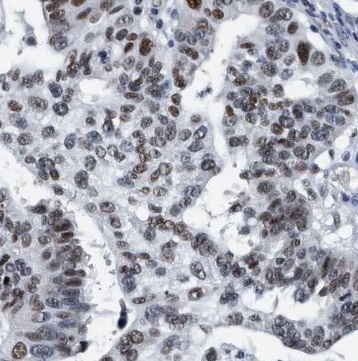 PELO antibody|PELO抗体