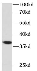 FST antibody|FST抗体 FNab03182