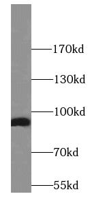 HSP90B1 antibody|HSP90B1抗体 FNa