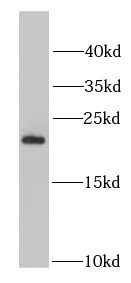 PSMB5 antibody|PSMB5抗体
