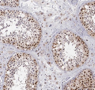 BBS5 antibody|BBS5抗体 FNab00819