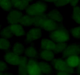 SUMO2/3 antibody|SUMO2/3抗体 FNa