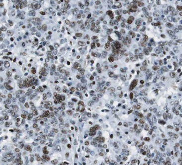 CCNH1 antibody|CCNH1抗体