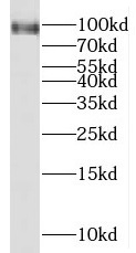 MGAT5B antibody|MGAT5B抗体