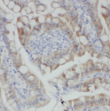 MGAT4A antibody|MGAT4A抗体