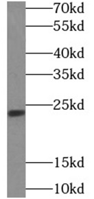 TWIST1 antibody|TWIST1抗体 FNab0