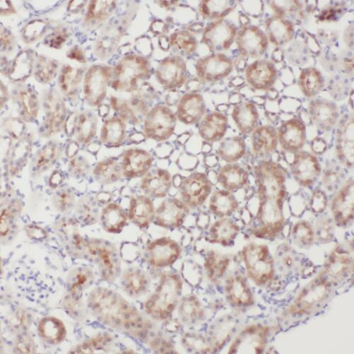 PTK2B antibody|PTK2B抗体 FNab069