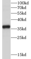 TYMS antibody|TYMS抗体