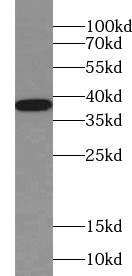 SYP antibody|SYP抗体 FNab08422