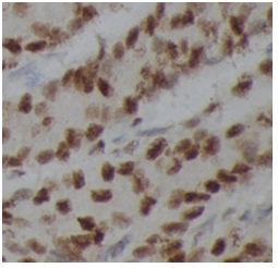 PARP1 antibody|PARP1抗体 FNab061