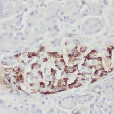 COX11 antibody|COX11抗体