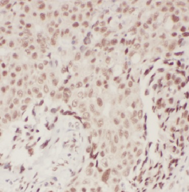 BRCA1 antibody|BRCA1抗体 FNab009