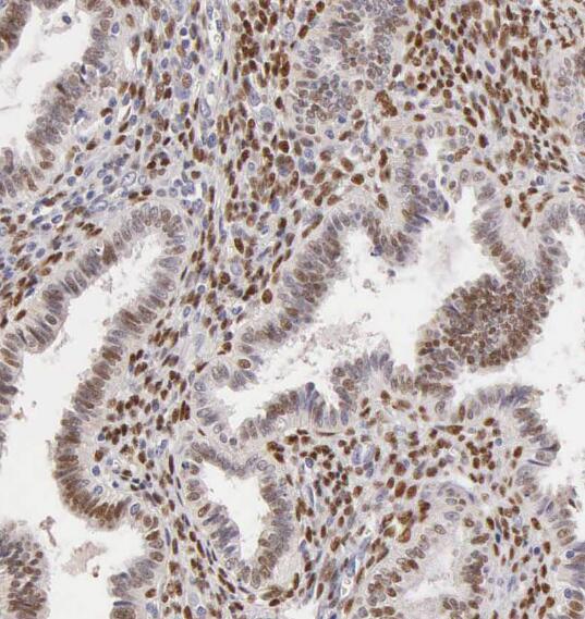 RPS27A antibody|RPS27A抗体