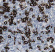 RAB27A-Specific antibody|RAB27