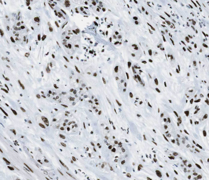 SHC1 antibody|SHC1抗体 FNab07839