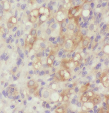 PELI2 antibody|PELI2抗体