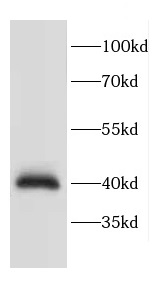 CACNG3 antibody|CACNG3抗体