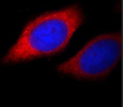 BMPR1A antibody|BMPR1A抗体