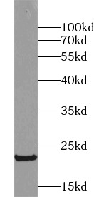 GH1 antibody|GH1抗体 FNab03660