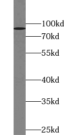 ZBTB49 antibody|ZBTB49抗体