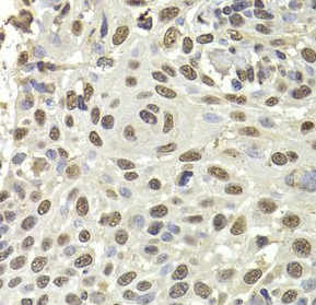 PUF60 antibody|PUF60抗体