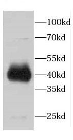 CDCA7 antibody|CDCA7抗体