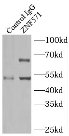 VDAC1 antibody|VDAC1抗体 FNab093