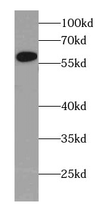 CYP4Z1-Specific antibody|CYP4Z