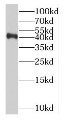 RABEPK antibody|RABEPK抗体 FNab0