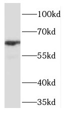 TCF7L1 antibody|TCF7L1抗体