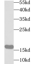 UBE2B antibody|UBE2B抗体