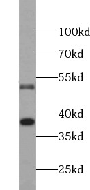 CASP8 antibody|CASP8抗体 FNab012