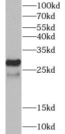 BIRC8 antibody|BIRC8抗体 FNab009