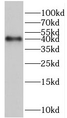 HERPUD2 antibody|HERPUD2抗体