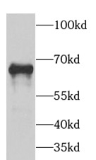 GAD1 antibody|GAD1抗体