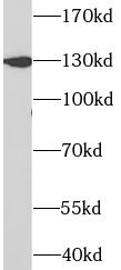 PRPF40A antibody|PRPF40A抗体