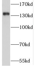 SORCS2 antibody|SORCS2抗体