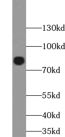 ACAP1 antibody|ACAP1抗体
