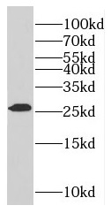 RABL2A antibody|RABL2A抗体