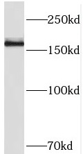 THADA antibody|THADA抗体