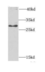 BPGM antibody|BPGM抗体