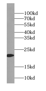 TIMM23 antibody|TIMM23抗体