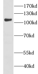 CHTF18 antibody|CHTF18抗体