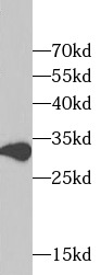 TXNL1 antibody|TXNL1抗体