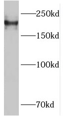 PLXNB1 antibody|PLXNB1抗体
